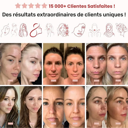 Masques visage Florelya™