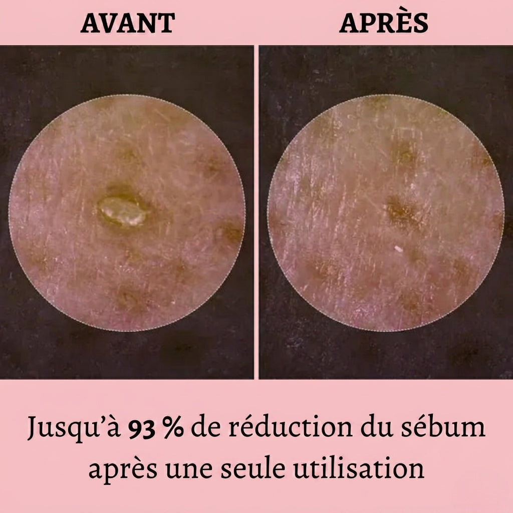 Florelya – Réinitialisation de la peau en 30 jours