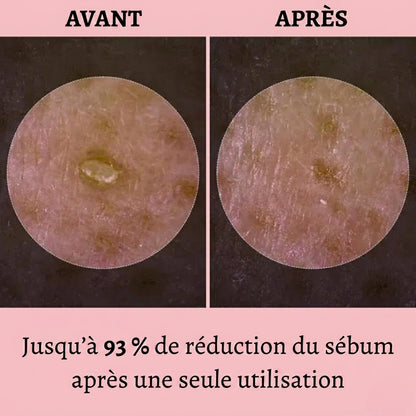 Florelya – Réinitialisation de la peau en 30 jours