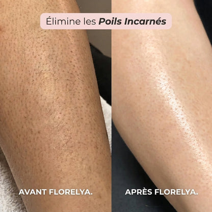 Rasoir 2-en-1 pour le Bikini et le Corps Florelya™