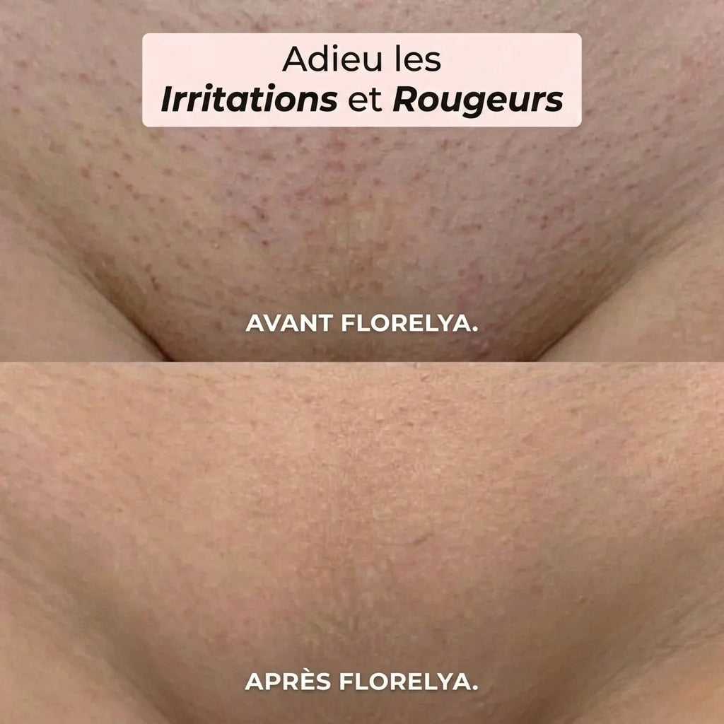 Rasoir 2-en-1 pour le Bikini et le Corps Florelya™