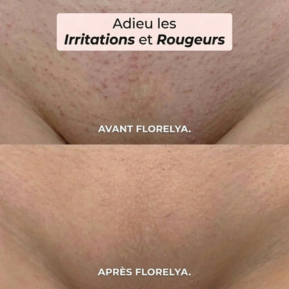 Rasoir 2-en-1 pour le Bikini et le Corps Florelya™