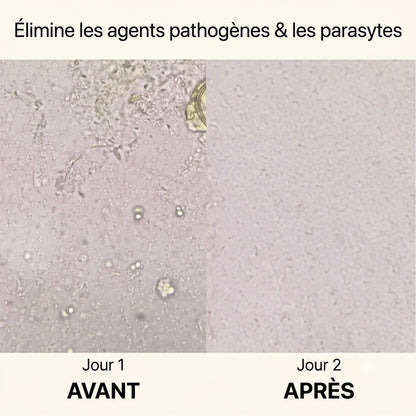 Ventre Plat – Soutien du côlon | Éliminez les parasites, purifiez vos intestins et sentez-vous plus légère
