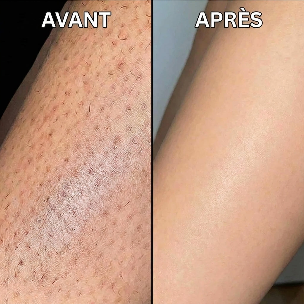Stop à la pousse des poils, formule végétale