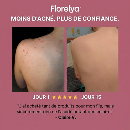 Savon Purifiant Anti-Acné™