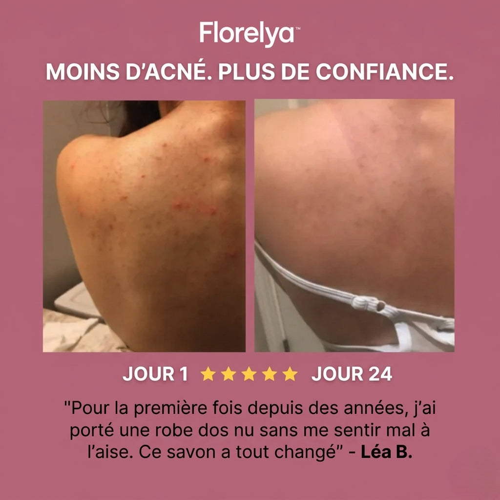 Savon Purifiant Anti-Acné™