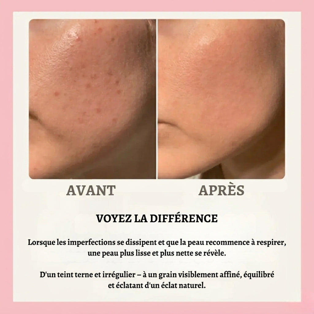 Florelya – Réinitialisation de la peau en 30 jours