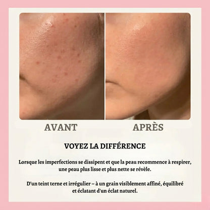 Florelya – Réinitialisation de la peau en 30 jours