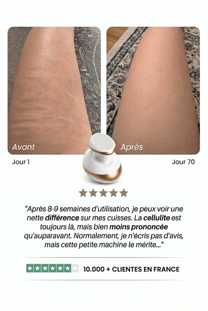 Florelya – Peau lisse en 14 jours