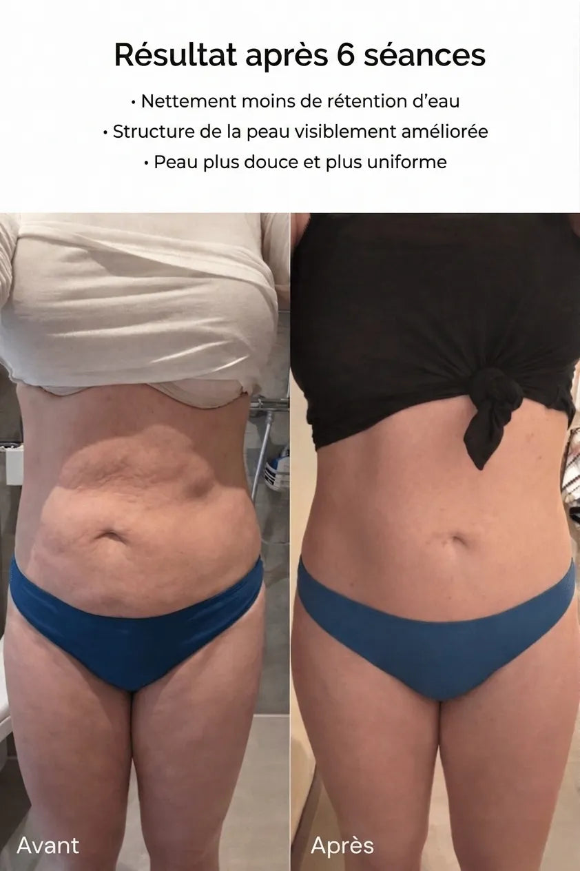 Florelya – Peau lisse en 14 jours