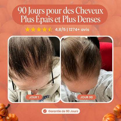 Réduit la chute des cheveux dès 30 jours d’utilisation