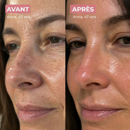 Florelya – Réinitialisation de la peau en 30 jours