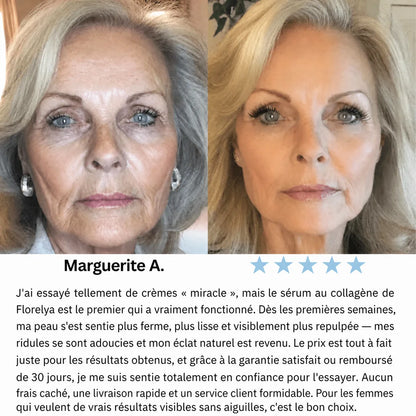 Volumia | Sérum Coréen au Collagène pour Peaux Matures — Florelya